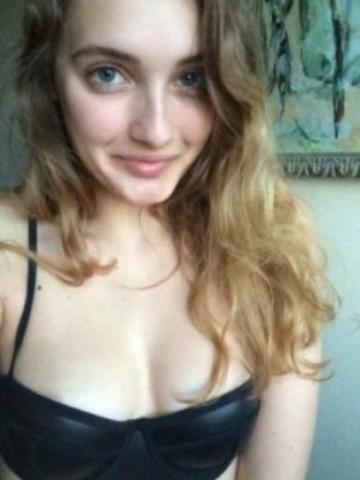 Альбина